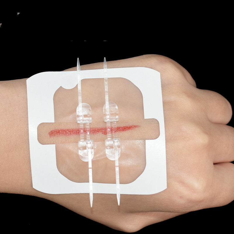 Skin Wound Reduction Sticking And Stretching Band-aid